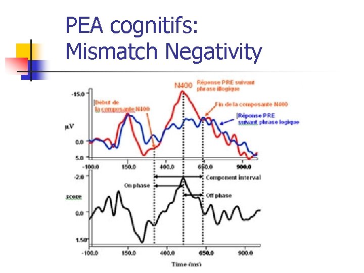 PEA cognitifs: Mismatch Negativity 