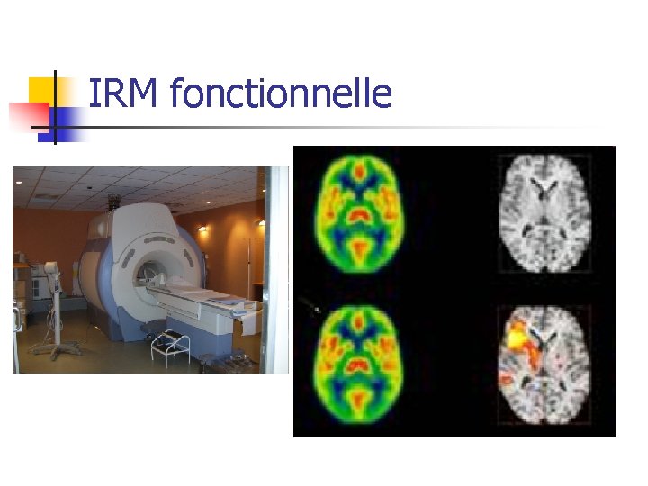 IRM fonctionnelle 