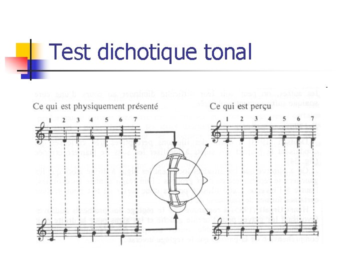 Test dichotique tonal 