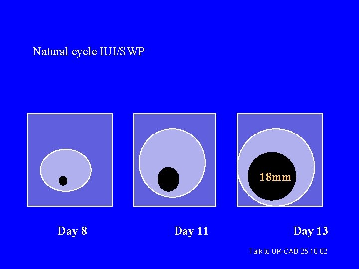 Natural cycle IUI/SWP 18 mm Day 8 Day 11 Day 13 Talk to UK-CAB