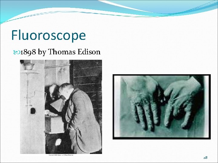 Fluoroscope 1898 by Thomas Edison 28 