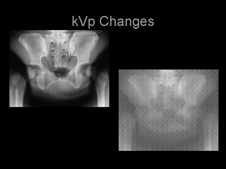 k. Vp Changes 