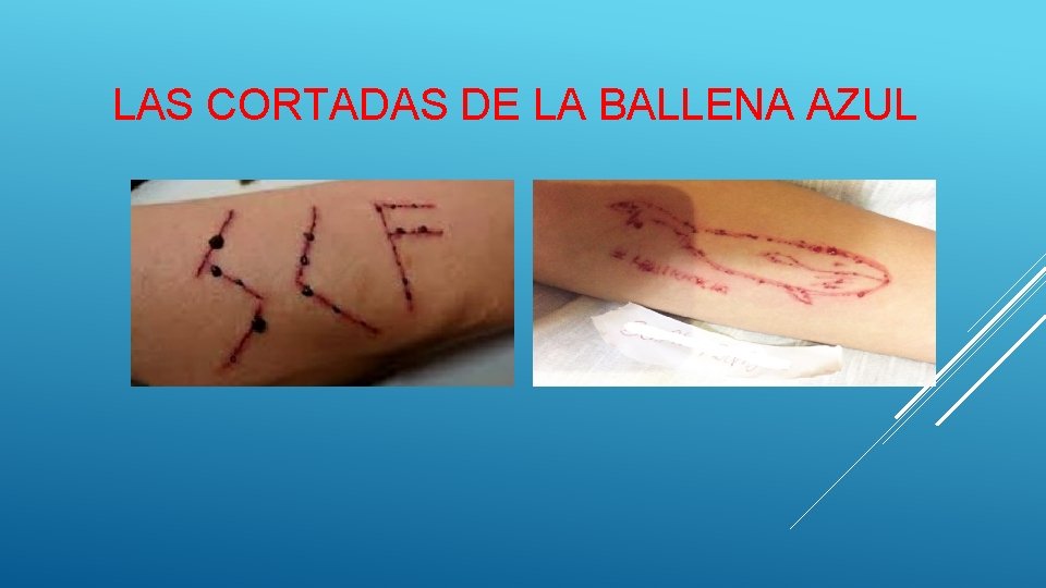 LAS CORTADAS DE LA BALLENA AZUL 