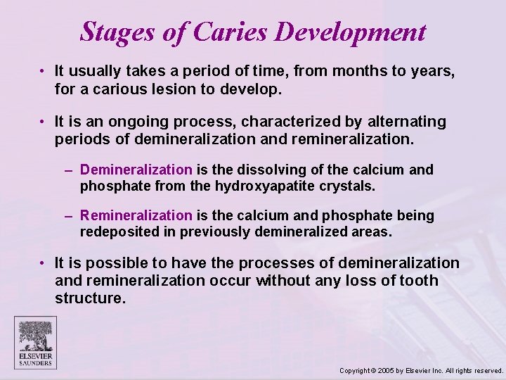 Stages of Caries Development • It usually takes a period of time, from months