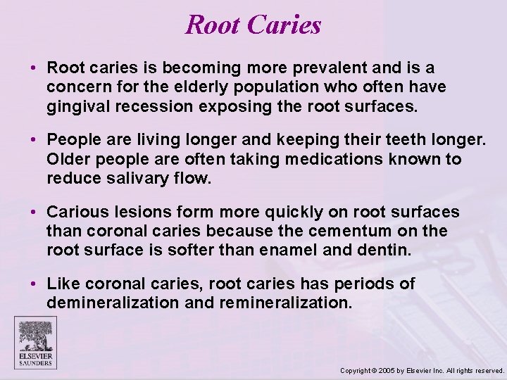 Root Caries • Root caries is becoming more prevalent and is a concern for