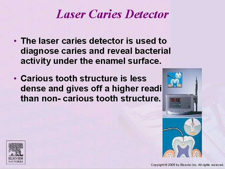 Laser Caries Detector • The laser caries detector is used to diagnose caries and