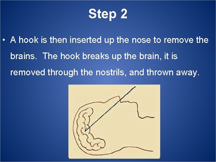 Step 2 • A hook is then inserted up the nose to remove the