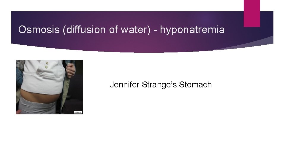 Osmosis (diffusion of water) - hyponatremia Jennifer Strange’s Stomach 