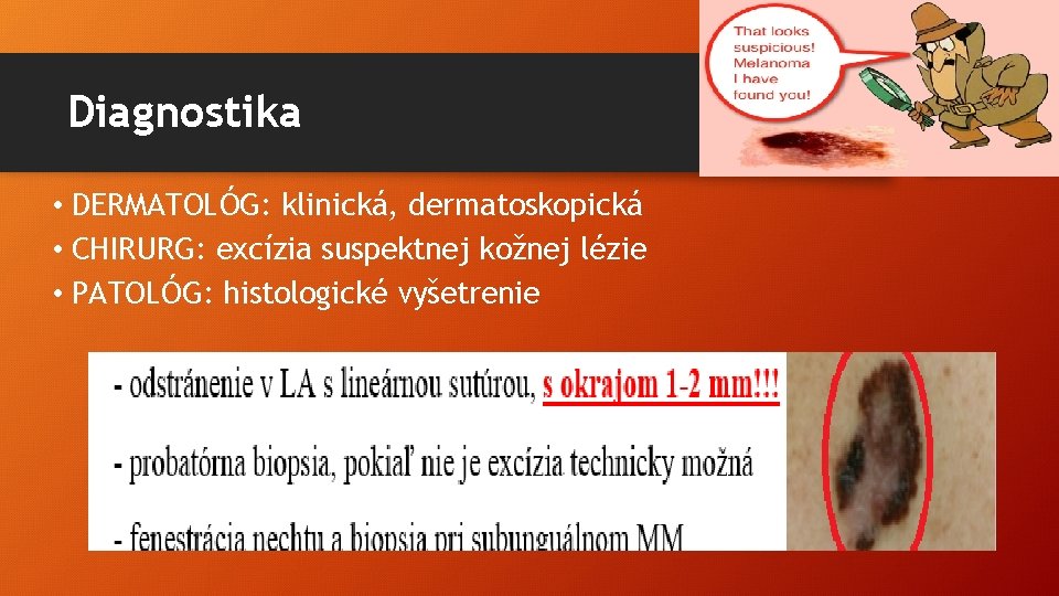 Diagnostika • DERMATOLÓG: klinická, dermatoskopická • CHIRURG: excízia suspektnej kožnej lézie • PATOLÓG: histologické