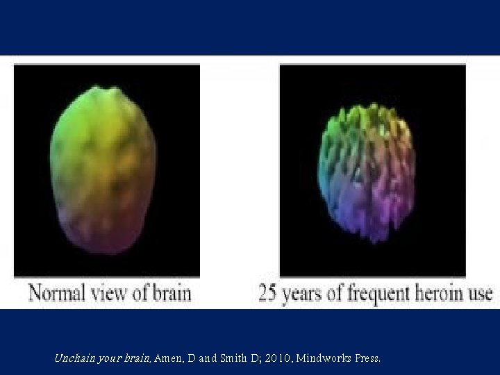 Unchain your brain, Amen, D and Smith D; 2010, Mindworks Press. 
