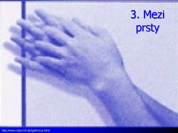 3. Mezi prsty http: //www. labor 28. de/igel/mrsa. html 