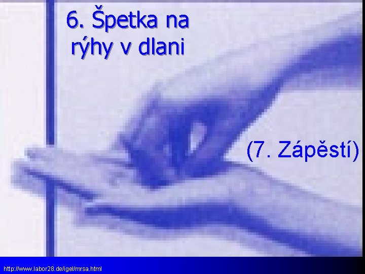 6. Špetka na rýhy v dlani (7. Zápěstí) http: //www. labor 28. de/igel/mrsa. html