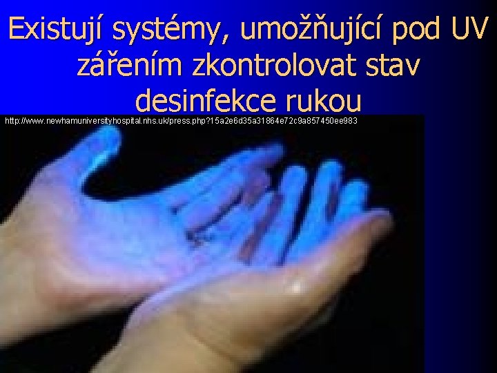 Existují systémy, umožňující pod UV zářením zkontrolovat stav desinfekce rukou http: //www. newhamuniversityhospital. nhs.