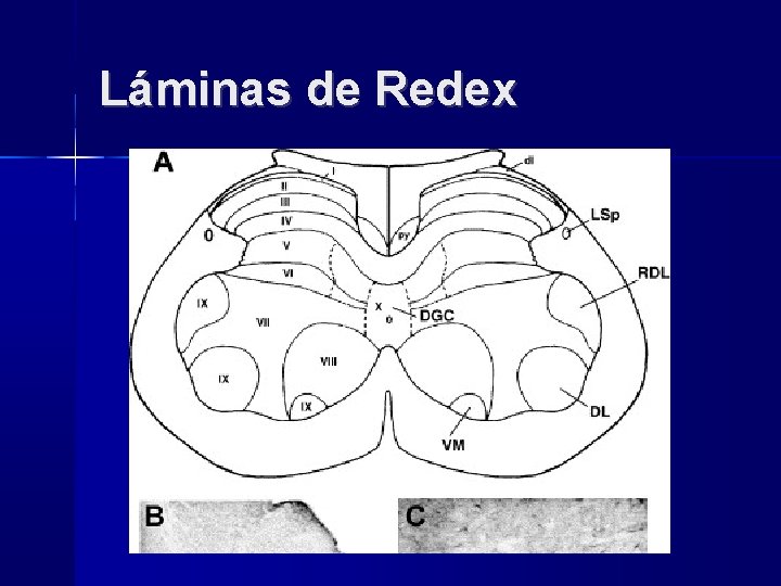 Láminas de Redex 