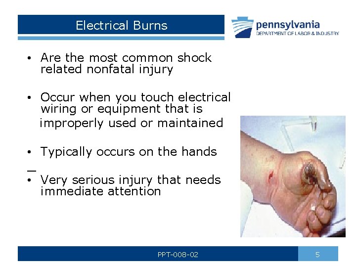 Electrical Burns • Are the most common shock related nonfatal injury • Occur when Electrical Burns • Are the most common shock related nonfatal injury • Occur when
