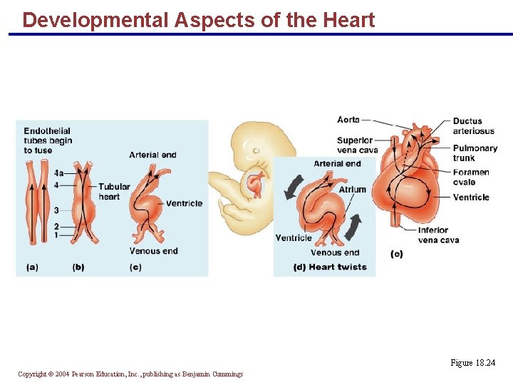 Developmental Aspects of the Heart Figure 18. 24 Copyright © 2004 Pearson Education, Inc.