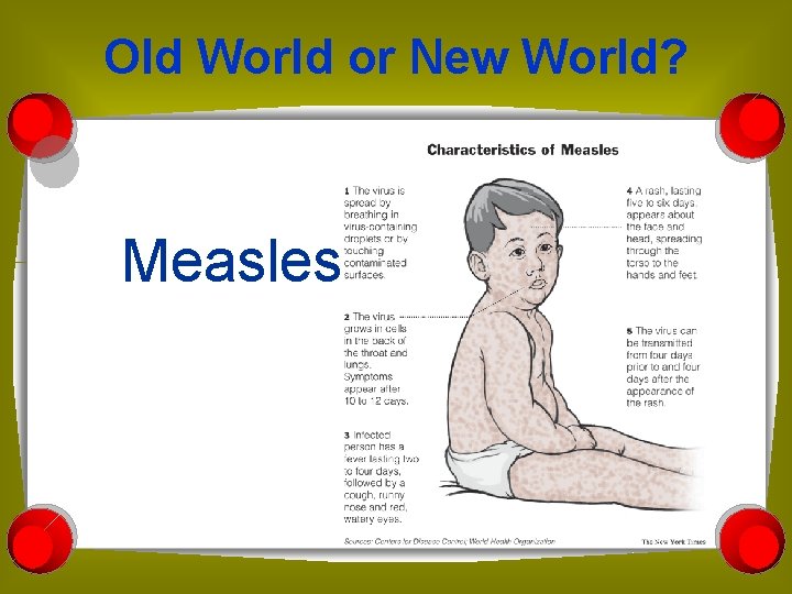 Old World or New World? Measles 