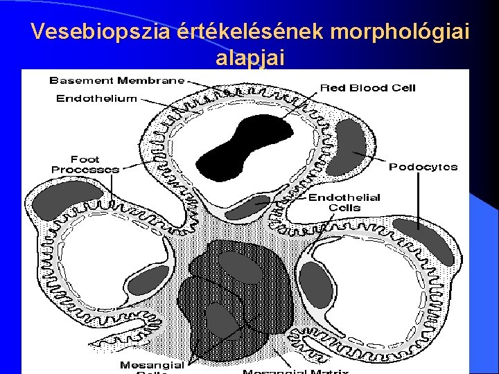 Vesebiopszia értékelésének morphológiai alapjai l 