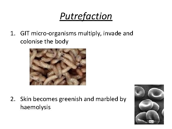 Putrefaction 1. GIT micro-organisms multiply, invade and colonise the body 2. Skin becomes greenish