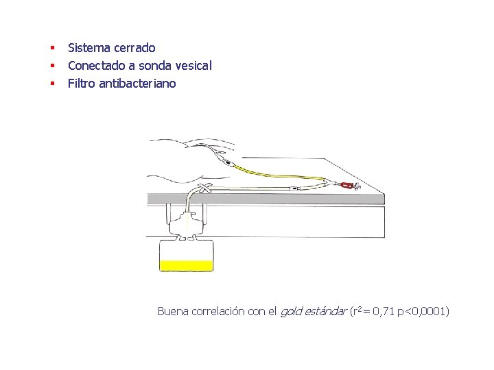 § § § Sistema cerrado Conectado a sonda vesical Filtro antibacteriano Buena correlación con