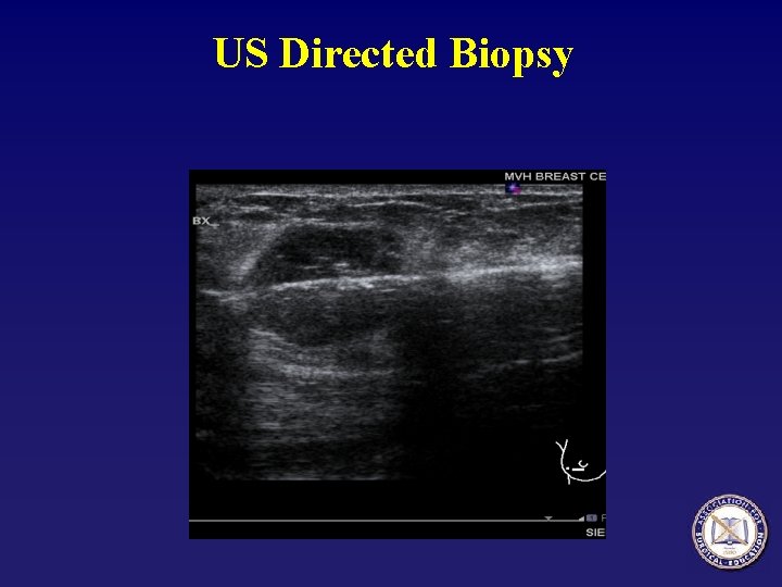 US Directed Biopsy 