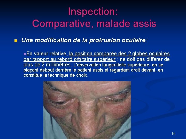 Inspection: Comparative, malade assis n Une modification de la protrusion oculaire: n. En valeur