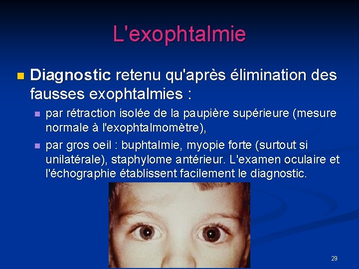 L'exophtalmie n Diagnostic retenu qu'après élimination des fausses exophtalmies : n n par rétraction