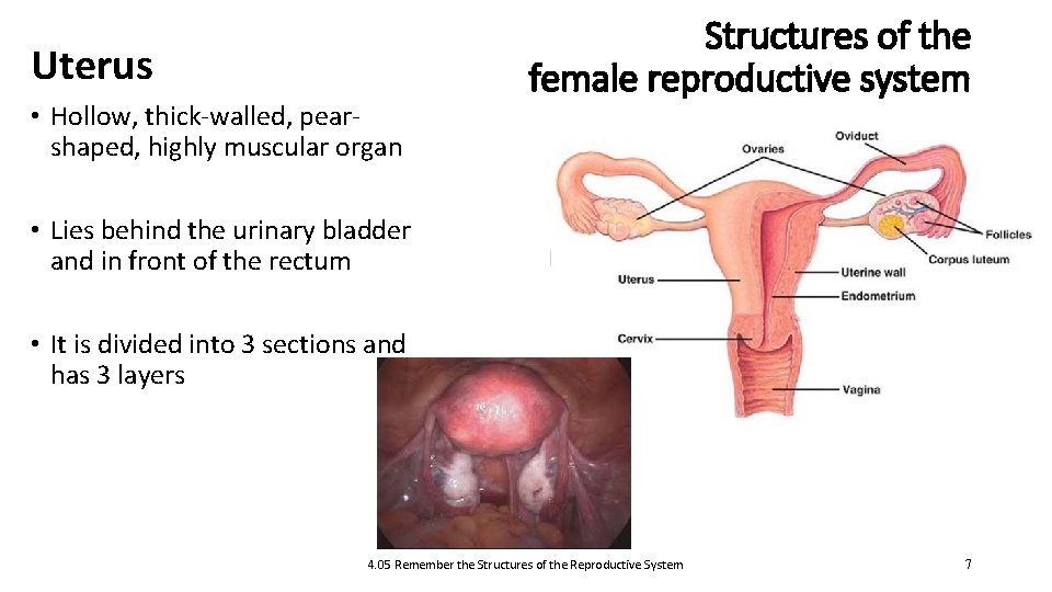 Uterus • Hollow, thick-walled, pearshaped, highly muscular organ Structures of the female reproductive system