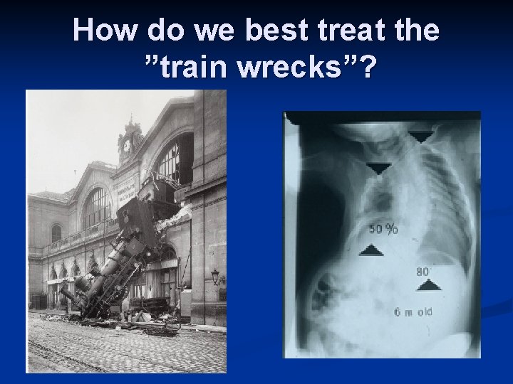 How do we best treat the ”train wrecks”? 