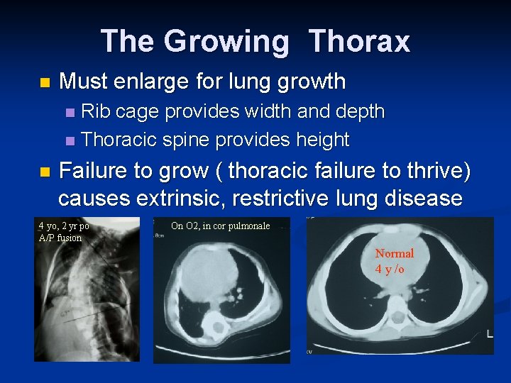 The Growing Thorax n Must enlarge for lung growth Rib cage provides width and