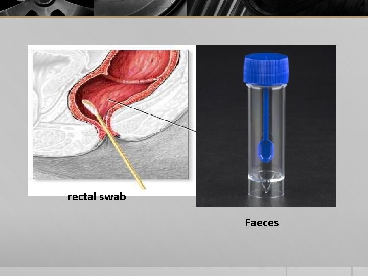 rectal swab Faeces 