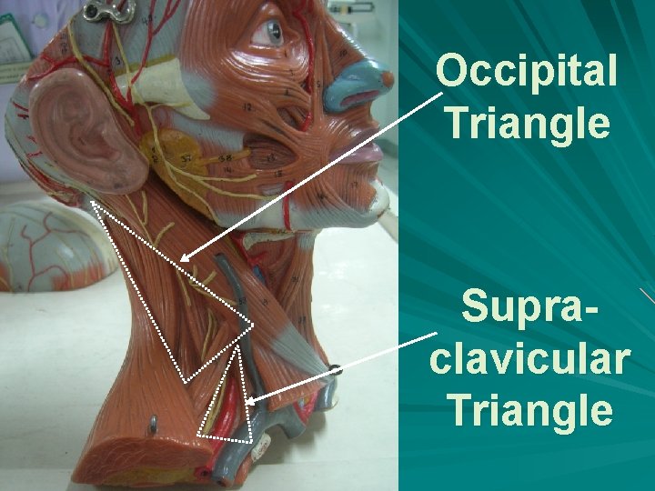 Occipital Triangle Supraclavicular Triangle 