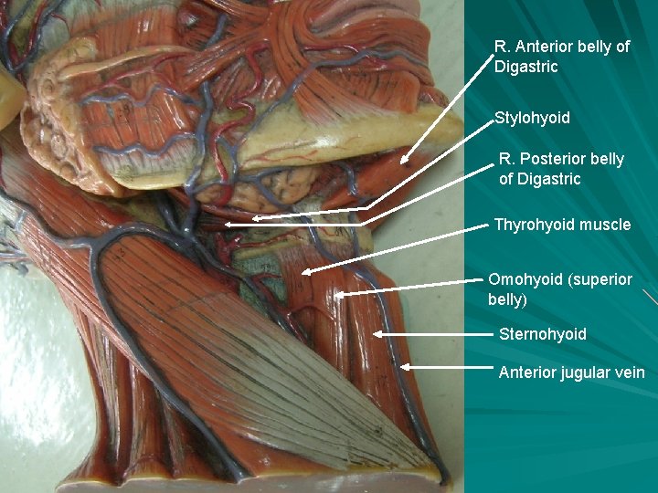 R. Anterior belly of Digastric Stylohyoid R. Posterior belly of Digastric Thyrohyoid muscle Omohyoid