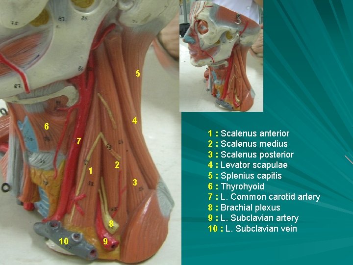 5 4 6 7 2 1 3 8 10 9 1 : Scalenus anterior