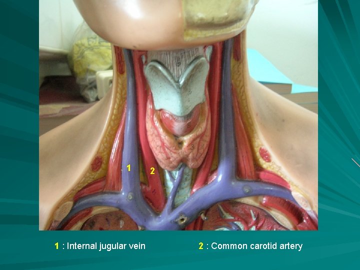 1 1 : Internal jugular vein 2 2 : Common carotid artery 
