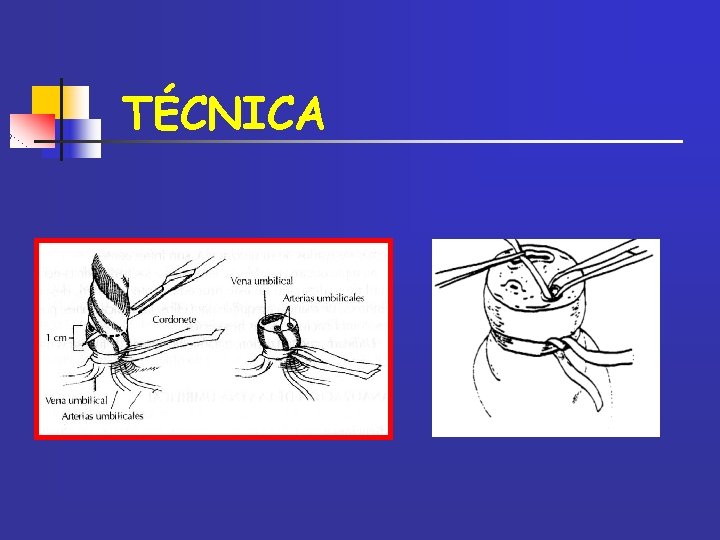 TÉCNICA 