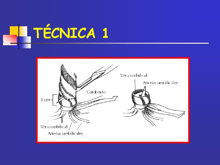 TÉCNICA 1 