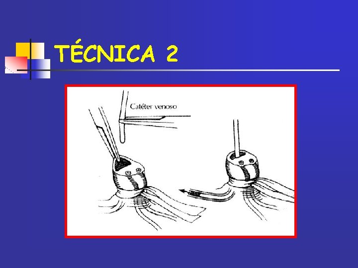 TÉCNICA 2 