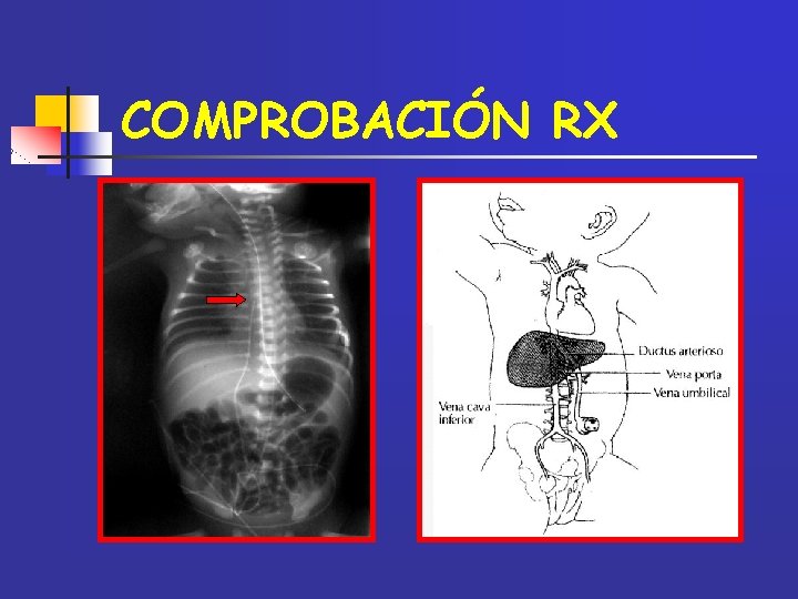 COMPROBACIÓN RX 