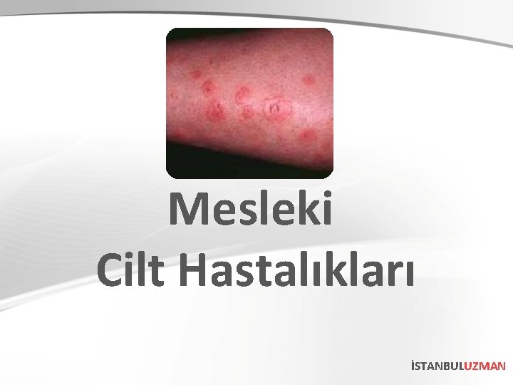 Mesleki Cilt Hastalıkları İSTANBULUZMAN 