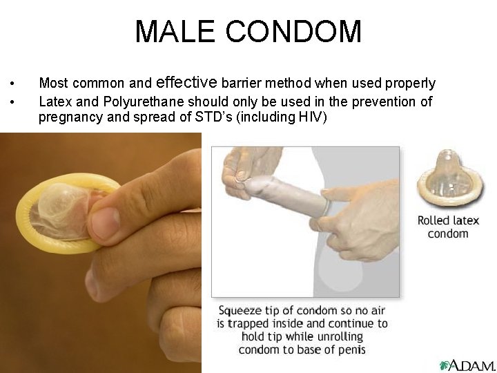 MALE CONDOM • • Most common and effective barrier method when used properly Latex