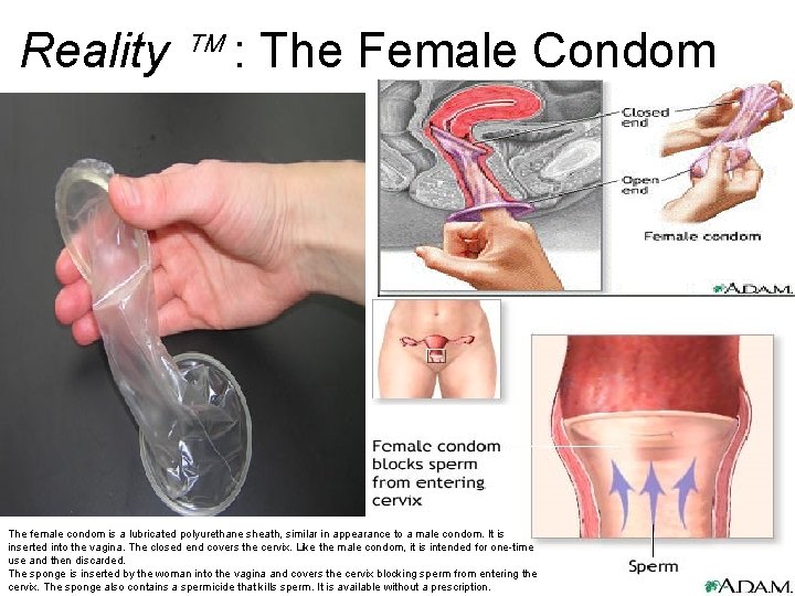 Reality : The Female Condom The female condom is a lubricated polyurethane sheath, similar