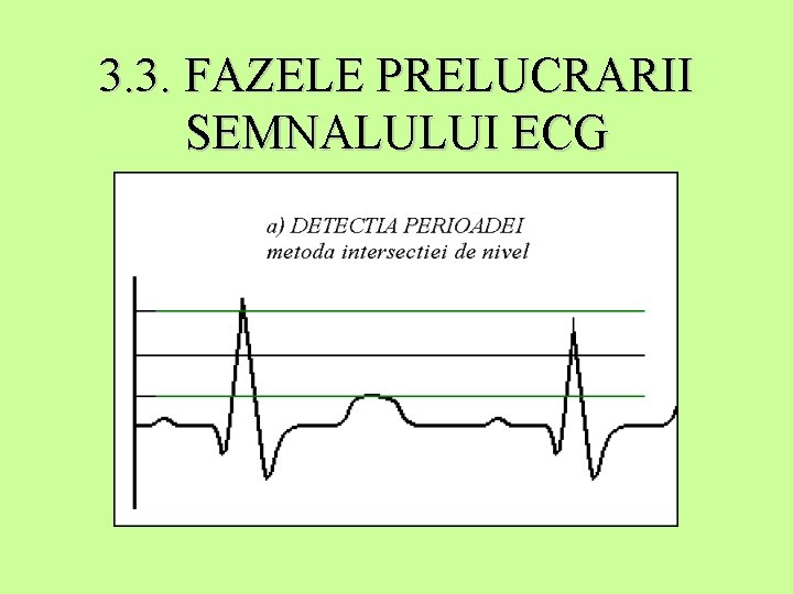 3. 3. FAZELE PRELUCRARII SEMNALULUI ECG 