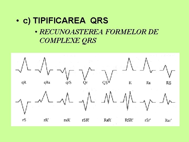  • c) TIPIFICAREA QRS • RECUNOASTEREA FORMELOR DE COMPLEXE QRS 