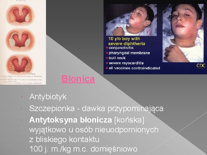 Błonica Antybiotyk Szczepionka - dawka przypominająca Antytoksyna błonicza [końska] wyjątkowo u osób nieuodpornionych z