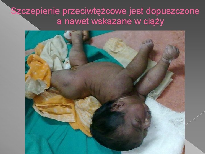 Szczepienie przeciwtężcowe jest dopuszczone a nawet wskazane w ciąży 