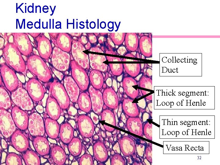 Kidney Medulla Histology Collecting Duct Thick segment: Loop of Henle Thin segment: Loop of