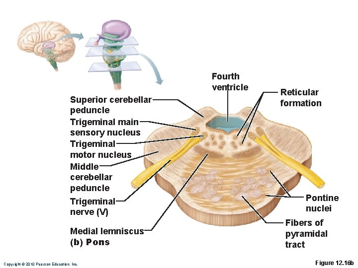 Fourth ventricle Superior cerebellar peduncle Trigeminal main sensory nucleus Trigeminal motor nucleus Middle cerebellar