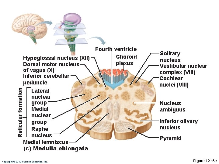 Reticular formation Fourth ventricle Choroid Hypoglossal nucleus (XII) plexus Dorsal motor nucleus of vagus