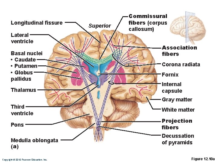 Longitudinal fissure Lateral ventricle Basal nuclei • Caudate • Putamen • Globus pallidus Thalamus